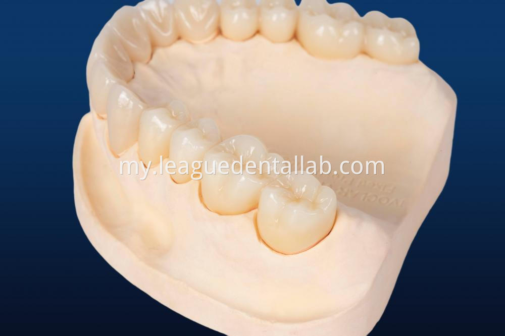 Full zirconia